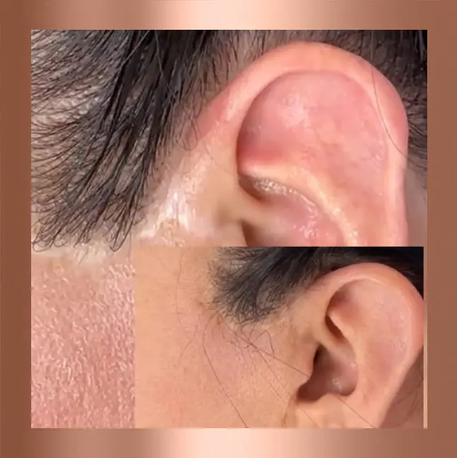 Close-up images of a person's ear and sideburn area.